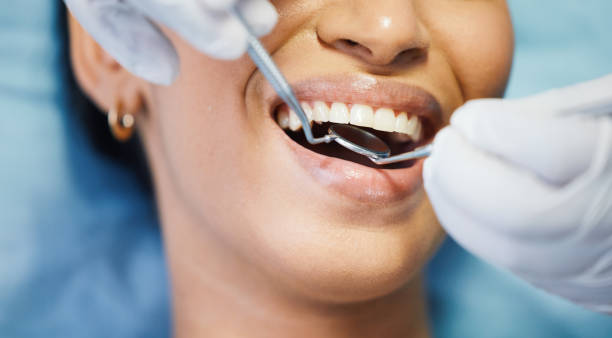 Best Emergency Treatment for Oral Infections in Springfield, MI